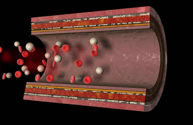 动脉,血管,无人,竖图,插画,室内,特写,白天,正面,数码,科技,静物,阴影,黑色背景,网络,医学,细胞,高光,几何,计算机图形,合成,图画,画,红色,血液,人体,电脑合成图,数码合成图,生物学,血细胞,漫画,白细胞,生理学,写实,具体,具象,红细胞,内膜,彩图,血管壁