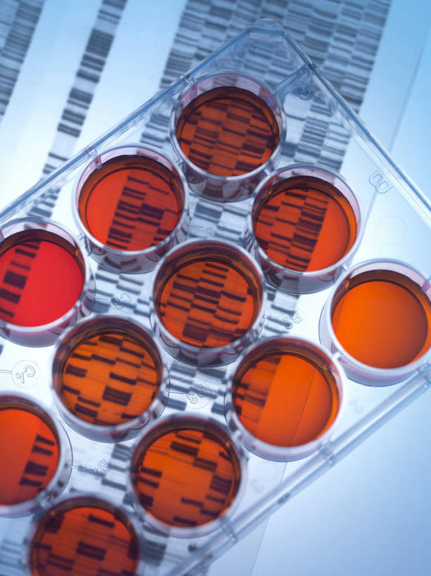 无人,竖图,俯视,室内,特写,白天,实验,仪器,水,一排,许多,阴影,蓝色背景,研究,整齐,并列,并排,反射,分析,科学,化学,基因,测试,圆形,培养皿,图形,液体,影子,圆,实验室,水滴,研究室,很多,几何,排列,橙色,器皿,生物,摄影,影棚,遗传,脱氧核糖核酸,队列,数学,平行,试验室,皮氏培养皿,试验耗材,实验用品,化学器材,DNA分子,去氧核糖核酸,遗传信息,遗传因子,遗传学,彩图,高角度拍摄,影棚拍摄,拍摄,几何图形,平面图形,DNA图谱,基因图,基因图谱