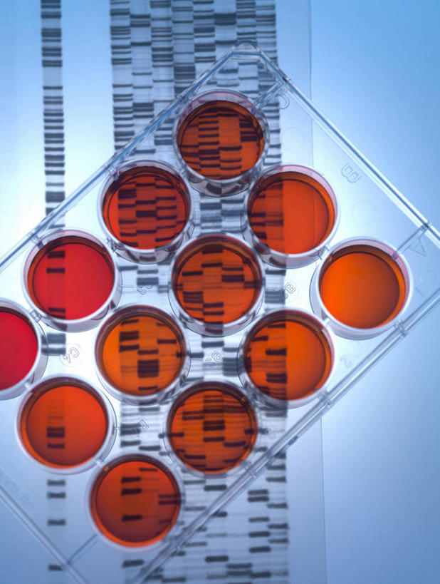 无人,竖图,俯视,室内,特写,白天,实验,仪器,水,一排,许多,阴影,蓝色背景,研究,整齐,并列,并排,反射,分析,科学,化学,基因,测试,圆形,培养皿,图形,液体,影子,圆,实验室,水滴,研究室,很多,几何,排列,橙色,器皿,生物,摄影,影棚,遗传,脱氧核糖核酸,队列,数学,平行,试验室,皮氏培养皿,试验耗材,实验用品,化学器材,DNA分子,去氧核糖核酸,遗传信息,遗传因子,遗传学,彩图,高角度拍摄,影棚拍摄,拍摄,几何图形,平面图形,DNA图谱,基因图,基因图谱