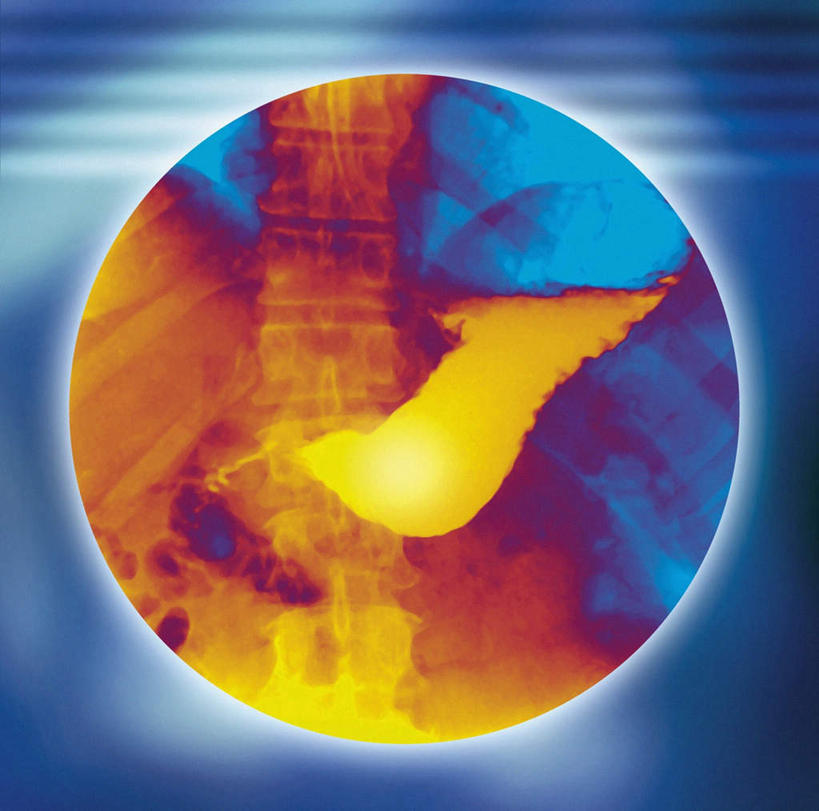 无人,横图,插画,x光片,室内,白天,正面,数码,科技,大脑,阴影,检查,辐射,科学,网络,医学,工具,高光,几何,计算机图形,合成,图画,画,扫描仪,器械,扫描,电脑合成图,数码合成图,检测,医疗,科学技术,x射线,医疗器械,断层,x光,医疗工具,漫画,写实,具体,具象,计算机断层扫描,ct机,扫描仪器,显像机,彩图,电磁波,电磁辐射