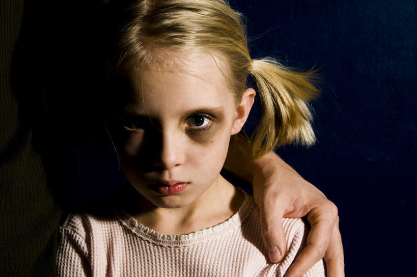 西方人,儿童,脸,头,脸颊,头发,两个人,家庭,父亲,女儿,站,横图,室内,白天,正面,纯洁,欧洲,欧洲人,阴影,服装,反射,影子,注视,休闲装,小孩,衣服,观察,看,站着,休闲,温暖,温馨,父女,一家人,辫子,休闲服,金色,父爱,可爱,童年,童趣,搭,服饰,观看,和睦,察看,搭着,关注,受伤,童真,烂漫,无邪,天真,男人,男性,年轻男性,女孩,白种人,孩子,年轻人,头部,脸部,脸蛋,面部,站立,半身,彩图,融洽,淤青,女生