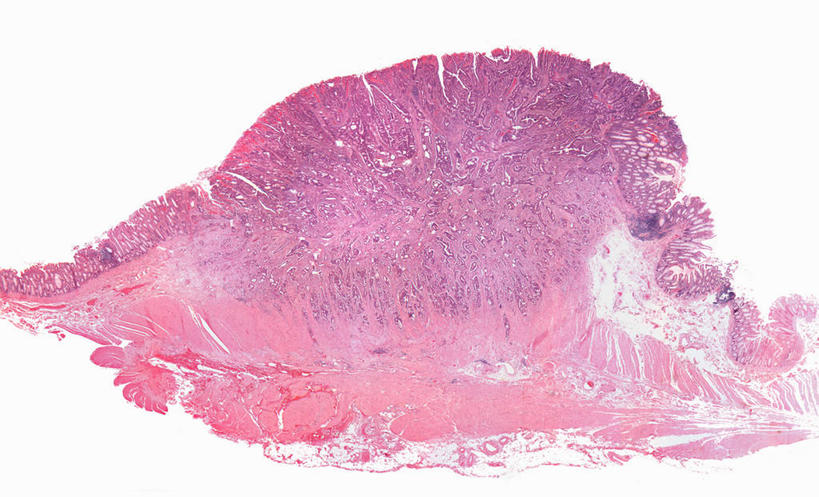 无人,横图,室内,特写,白天,白色背景,正面,微距,神秘,仪器,微生物,阴影,检查,反射,分析,科学,医学,细胞,显微镜,影子,紫色,观察,清晰,探索,放大,观看,仔细,透镜,疾病,生物学,优美,凸透镜,聚焦,庄重,高贵,关注,消极,肿瘤,癌症,光学,清楚,结肠癌,恶性肿瘤,冷色,显微图片,孤寂,彩图,微距摄影,奢华