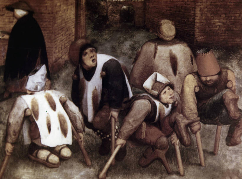 成年人,病人,横图,插画,室外,白天,绘画,数码,科技,帽子,油画,阴影,艺术,网络,高光,几何,计算机图形,古典,合成,图画,文化,画,工艺品,品味,治疗,乞丐,摄影,拐杖,美术,电脑合成图,数码合成图,手术,医疗,开刀,高雅,贫穷,合成图,病患,漫画,挑战,写实,具体,具象,美学,患者,就医者,步行,彩图,外科手术