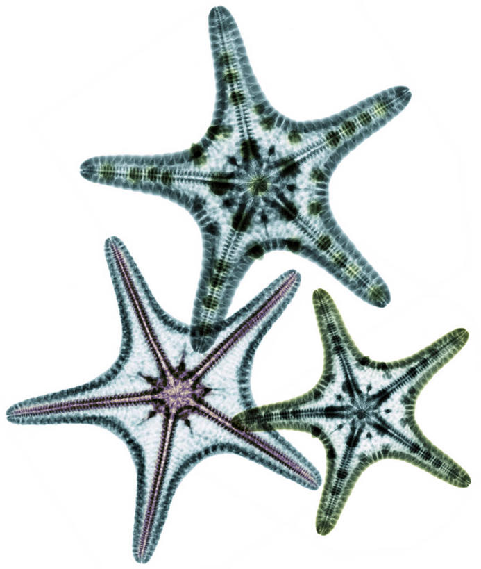 无人,竖图,x光片,室内,特写,白天,白色背景,正面,海星,辐射,科学,医学,纹路,纹理,海洋生物,三个,绿色,动物,生物,医疗,科学技术,x射线,x光,肌理,棘皮动物门,星鱼,彩图,全身,电磁波,电磁辐射